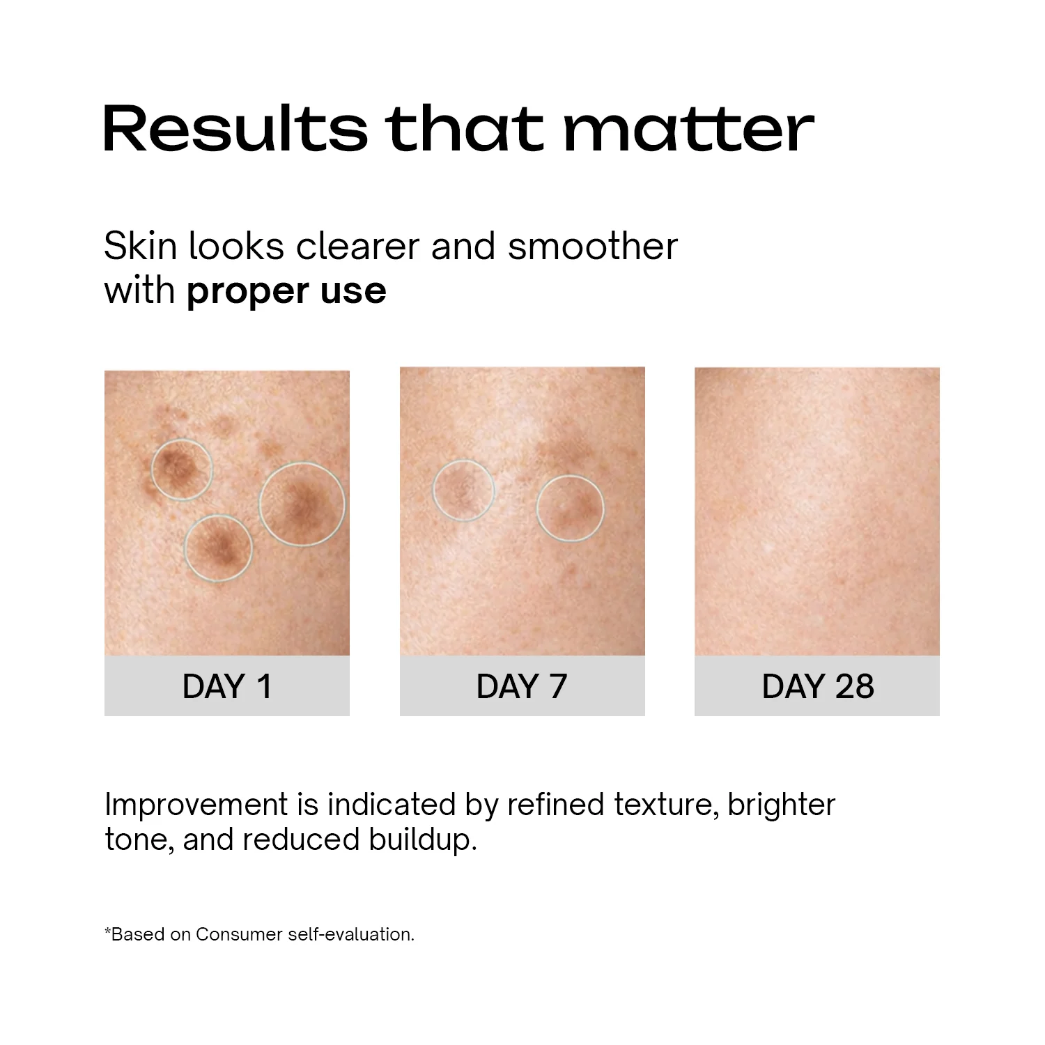 25% Aha + 2% Bha + 5% Pha Peeling Solution - Image 5