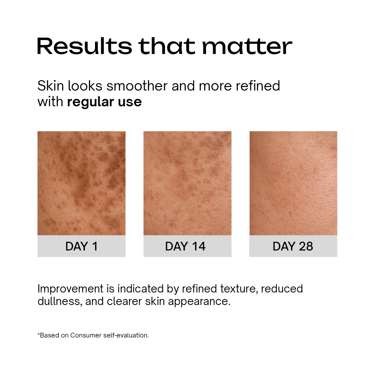 8% Glycolic Acid + 1% Salicylic Acid + 1% GDL Multipurpose Toning Solution - Image 5