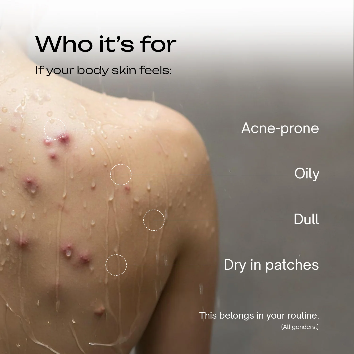 Acne Free Body Moisturizer - Image 5