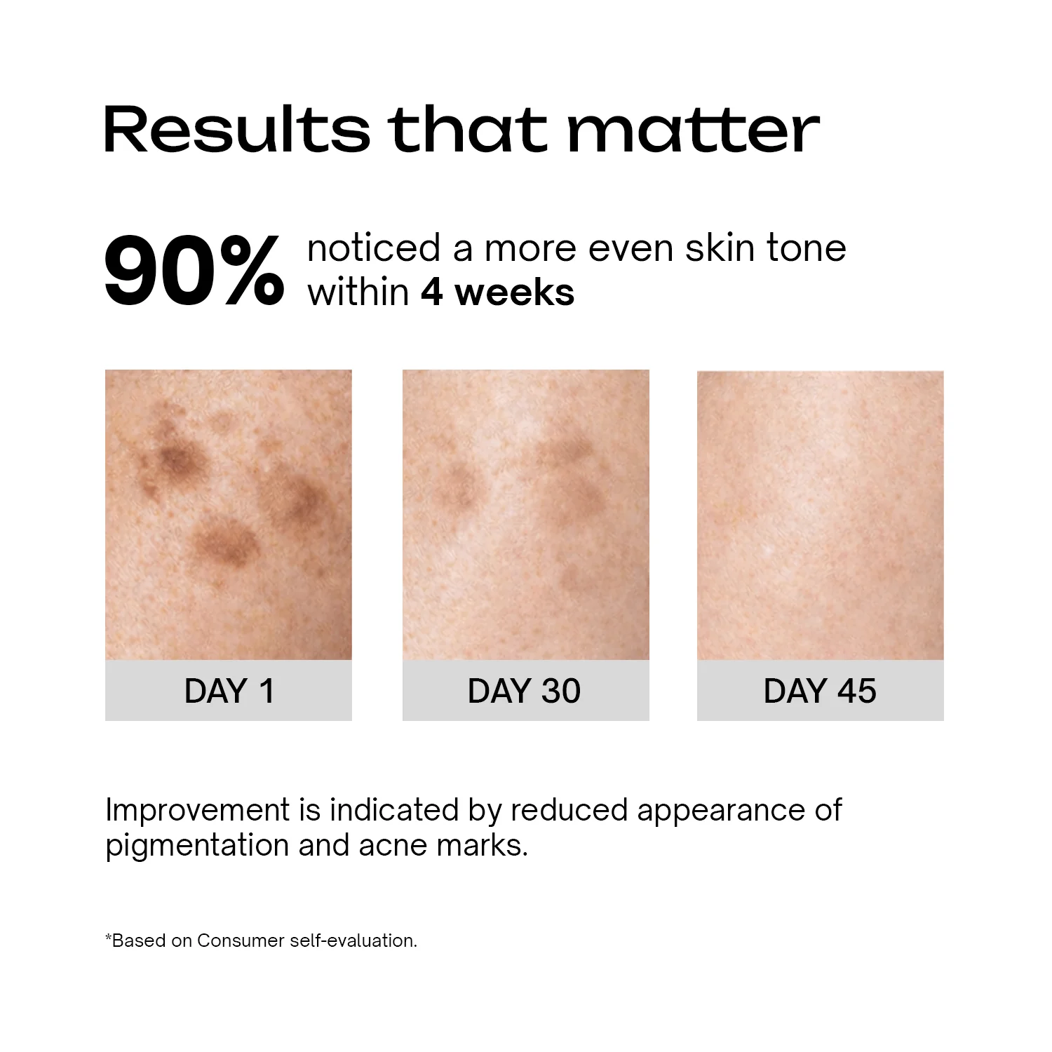 Alpha Arbutin 2% + Niacinamide 1% Serum - Image 4