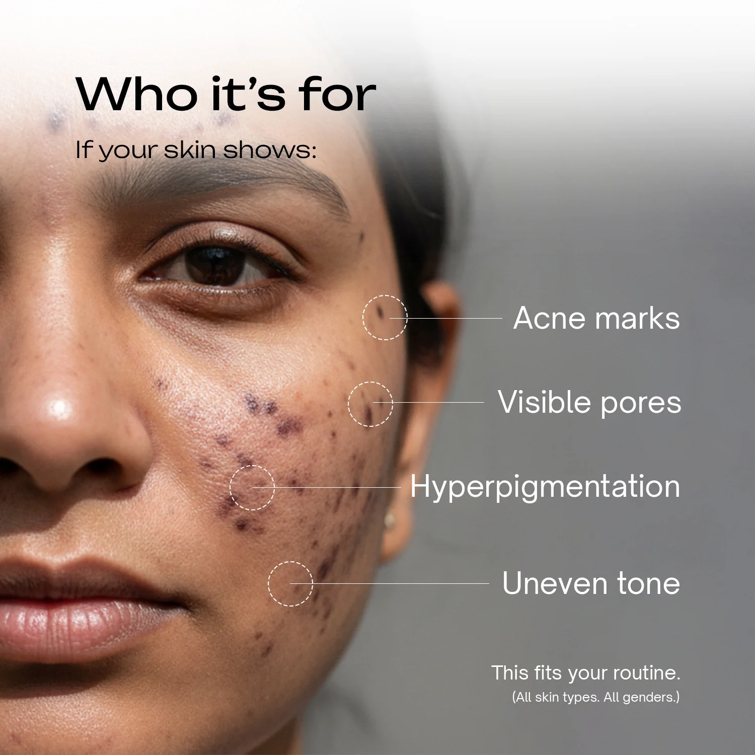 Alpha Arbutin 2% + Niacinamide 1% Serum - Image 6