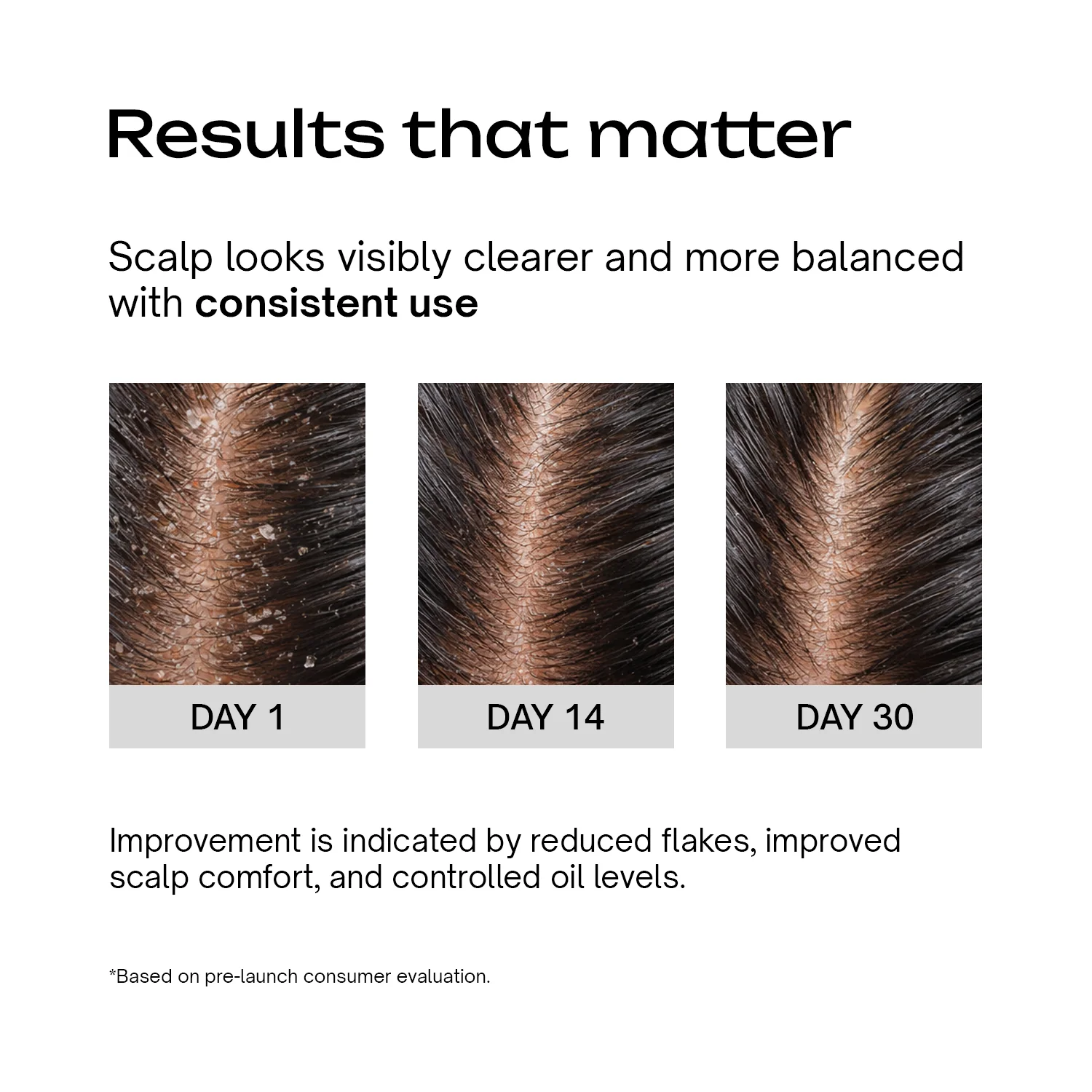 Anti-Dandruff Scalp Serum - Image 4