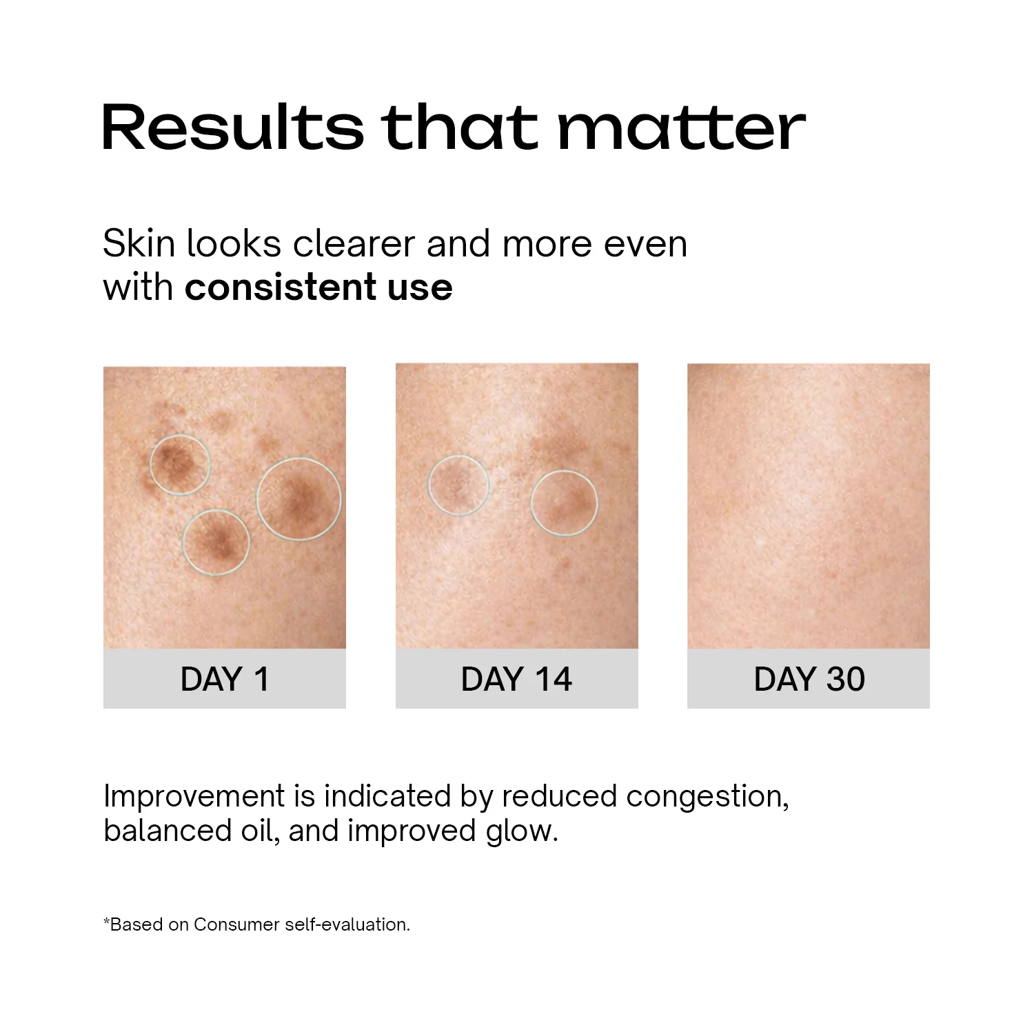 Glow and Acne Clear Face Moisturiser - Image 4