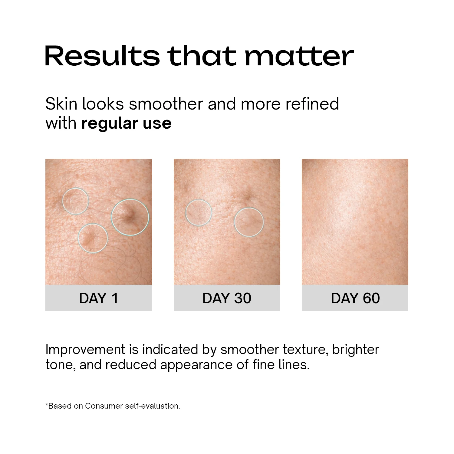 Retinol Serum for Beginners - Image 4