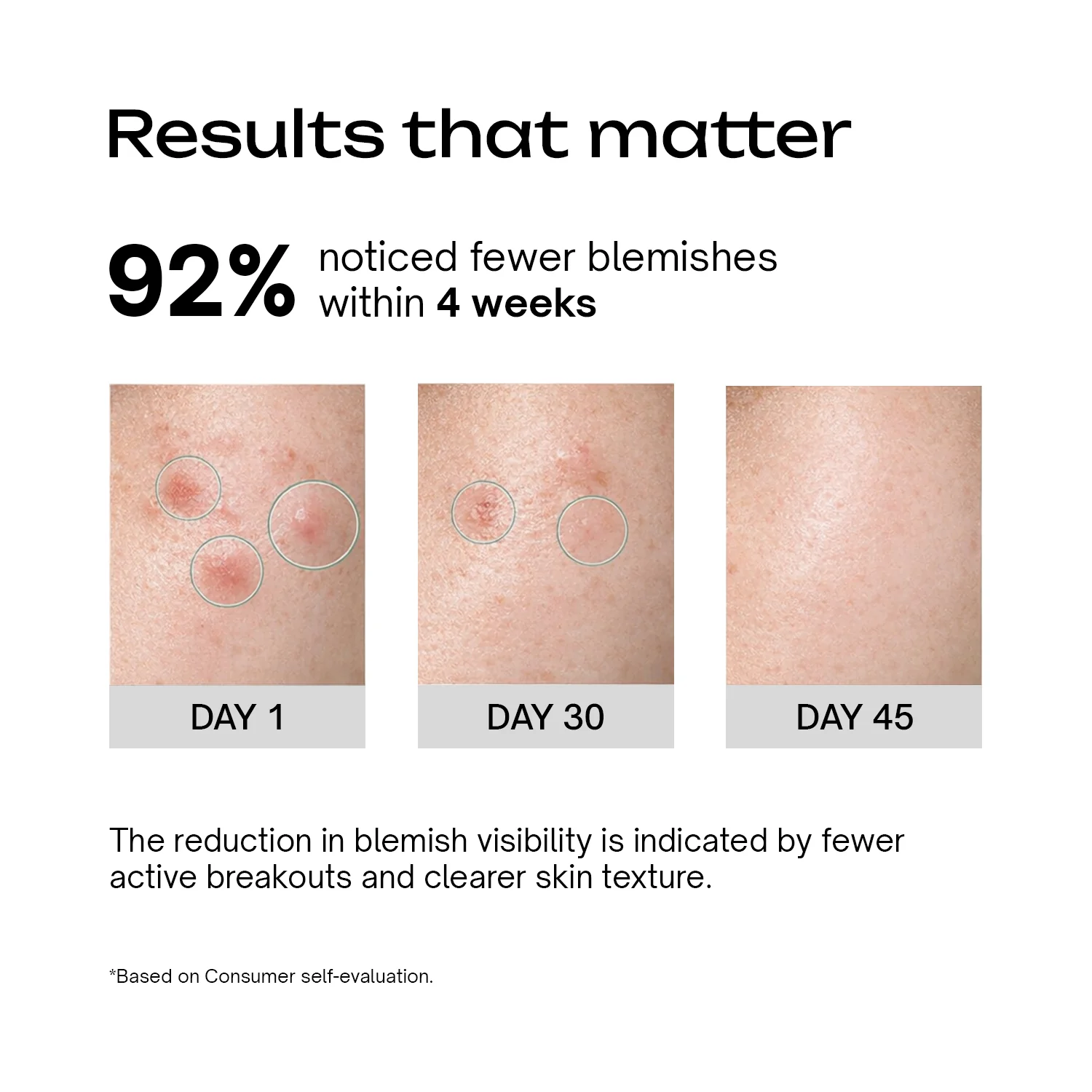 Salicylic Acid 2% + Tranexamic Acid 2% Serum - Image 4