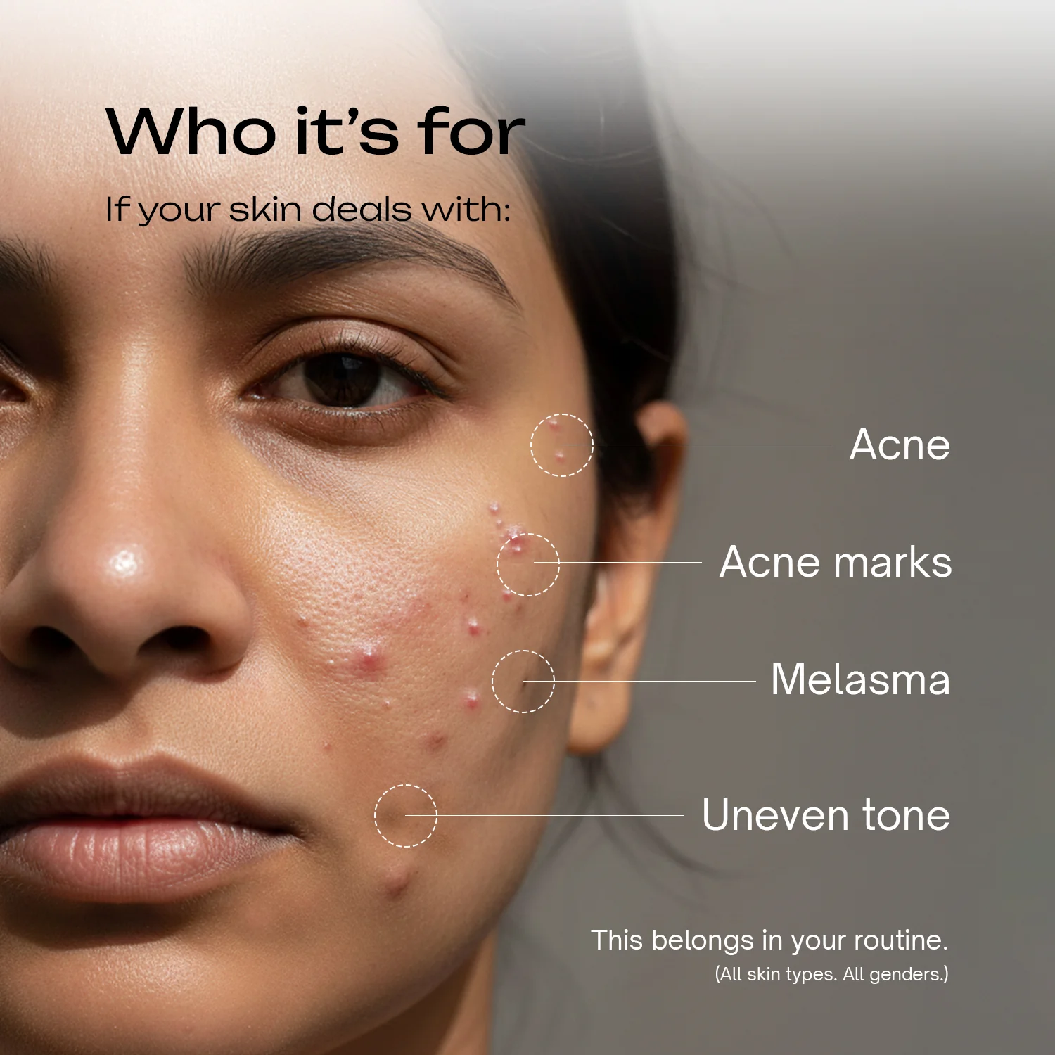 Salicylic Acid 2% + Tranexamic Acid 2% Serum - Image 6