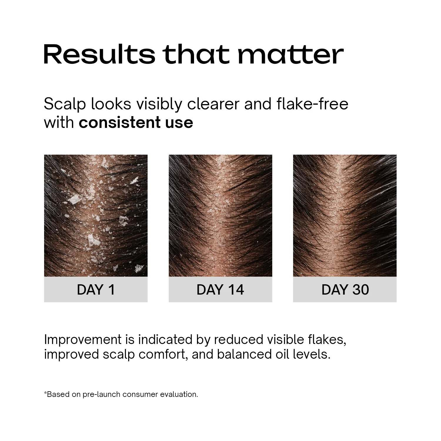 SLS-Free Anti-Dandruff Shampoo - Image 4