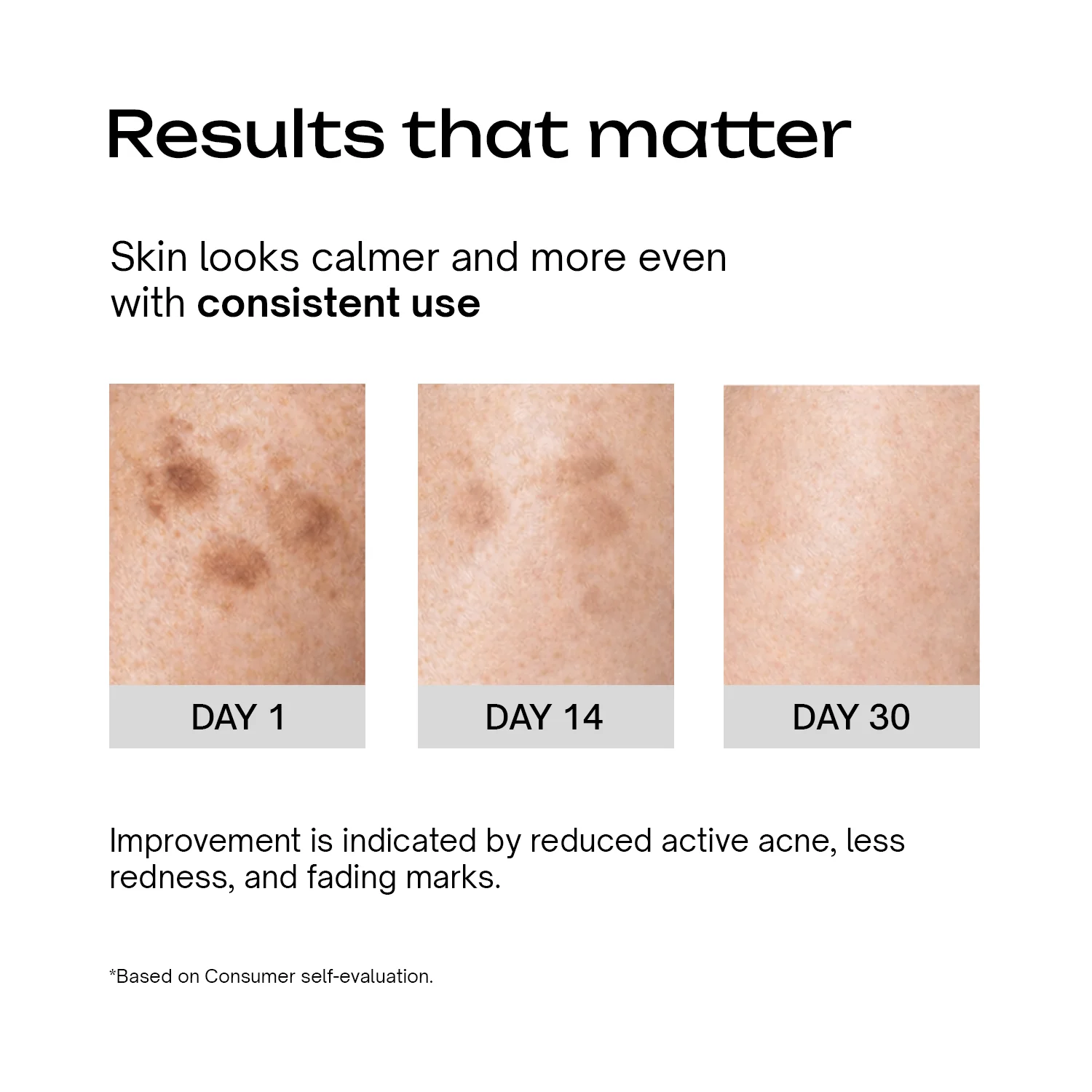 Azelaic Acid 9% GDL 5% Niacinamide 4% Cream - Image 4