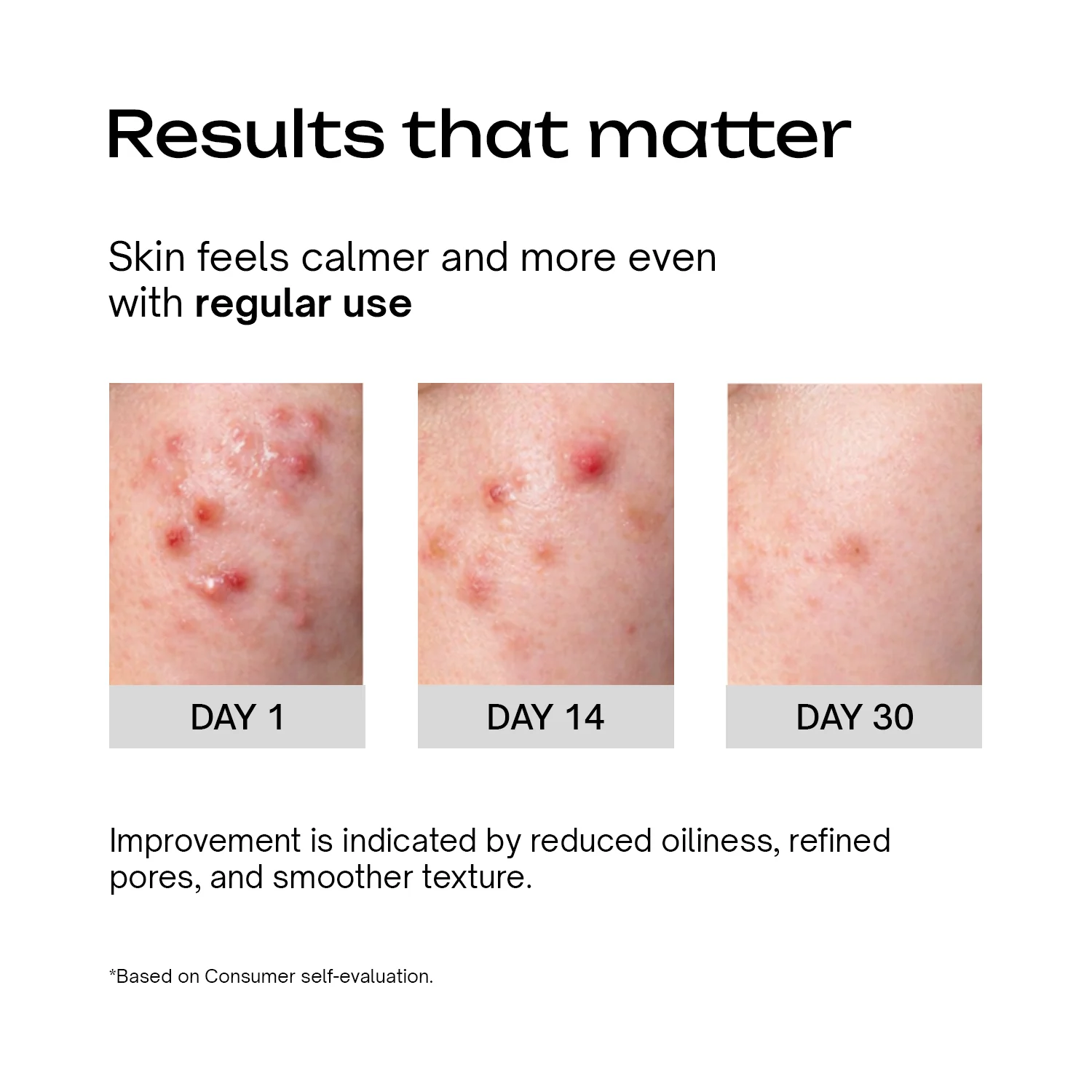 Niacinamide 5% Betaine 3% Serum - Image 4